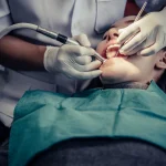 How Root Canal Therapy Saves Your Natural Tooth