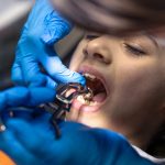 simple vs surgical tooth extraction