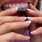 mouthguard benefits teeth protection