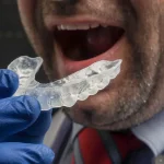 when to replace your mouthguard